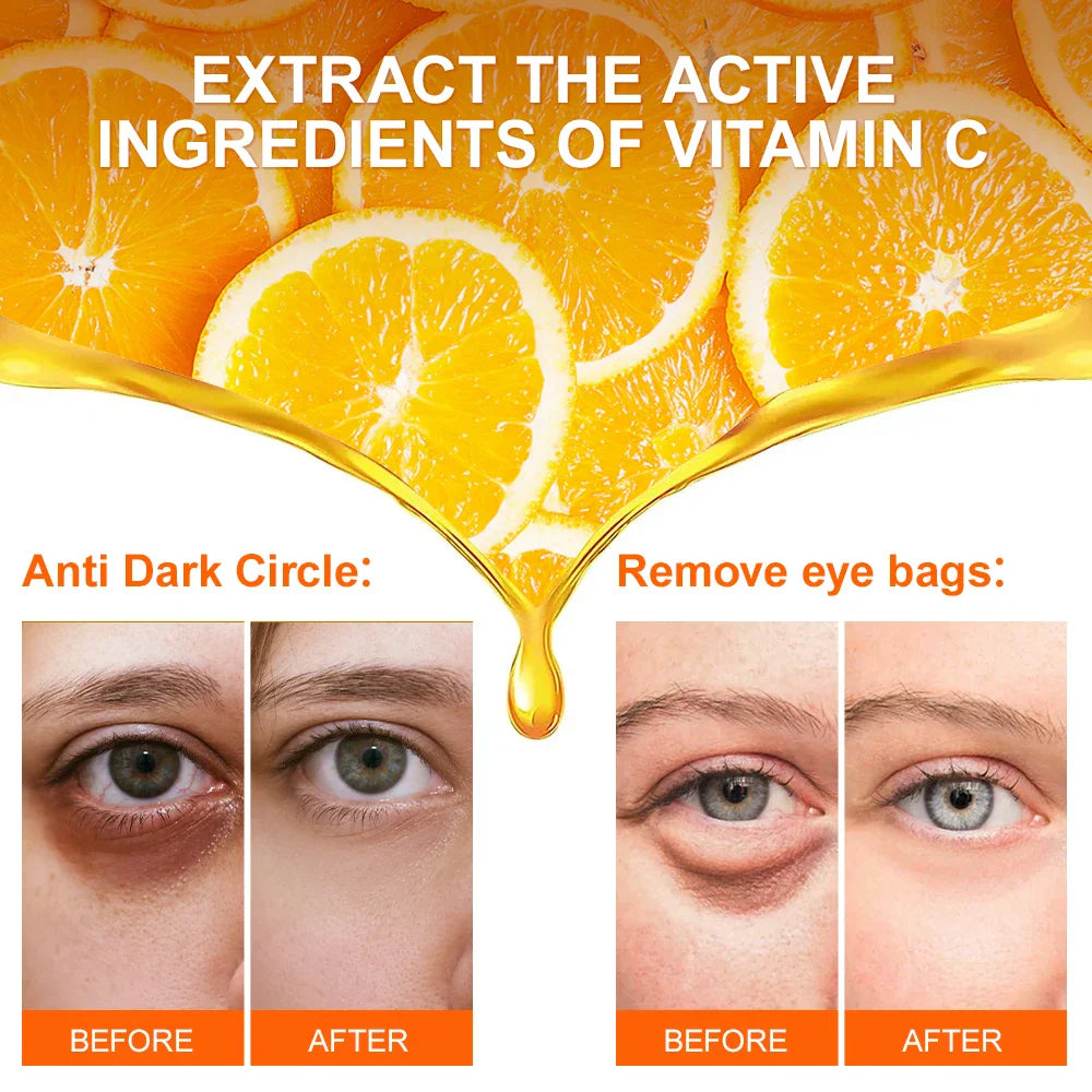 Anti Dark Circles| Eye Cream| Eye Bags